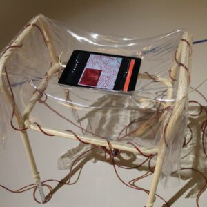A cream coloured walking frame is situated in a white room. Wrapped around the walking frame are red wires and clear plastic sheeting. Sitting on top of the walking frame is a small screen which is showing blood cells as seen through a microscope.